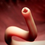 An Alien Attachment